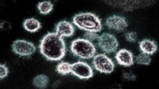 تم اكتشاف أول حالة مصابة بسلالة أوميكرون شديدة التحور في كندا