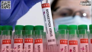 زيمبابوي تسجل أولى إصابات جدري القردة