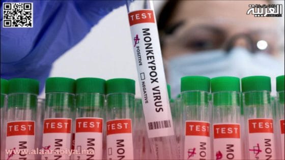 زيمبابوي تسجل أولى إصابات جدري القردة