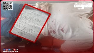 محاولة قتل بسبب خلاف حول الرعي بدوار البواشة.. فلاح يتعرض لاعتداء داخل منزله بساطور